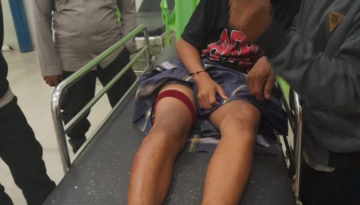 Remaja 14 Tahun di Wonomulyo Ditusuk OTK, Polisi Kejar Pelaku
