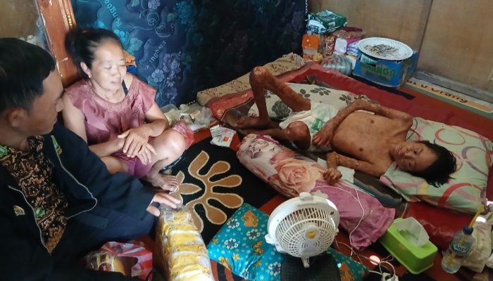 Perjuangan Seorang Ibu di Bulubawang Rawat Anak Yang Tiga Tahun Digerogoti Penyakit